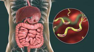 Az emésztőszervrendszer 3D vizualizációja, mely nagyításban kiemelt részén a gyomorfekély egyik okozója, a helicobacter pylori látható