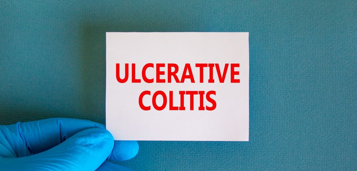 A colitis ulcerosa vagyis a fekélyes vastagbélgyulladás