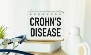 A Crohn betegség a bél gyulladásos megbetegedése