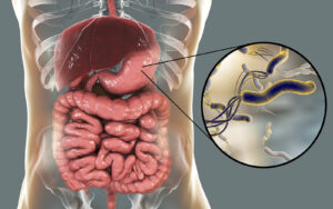 Helicobacter pylori