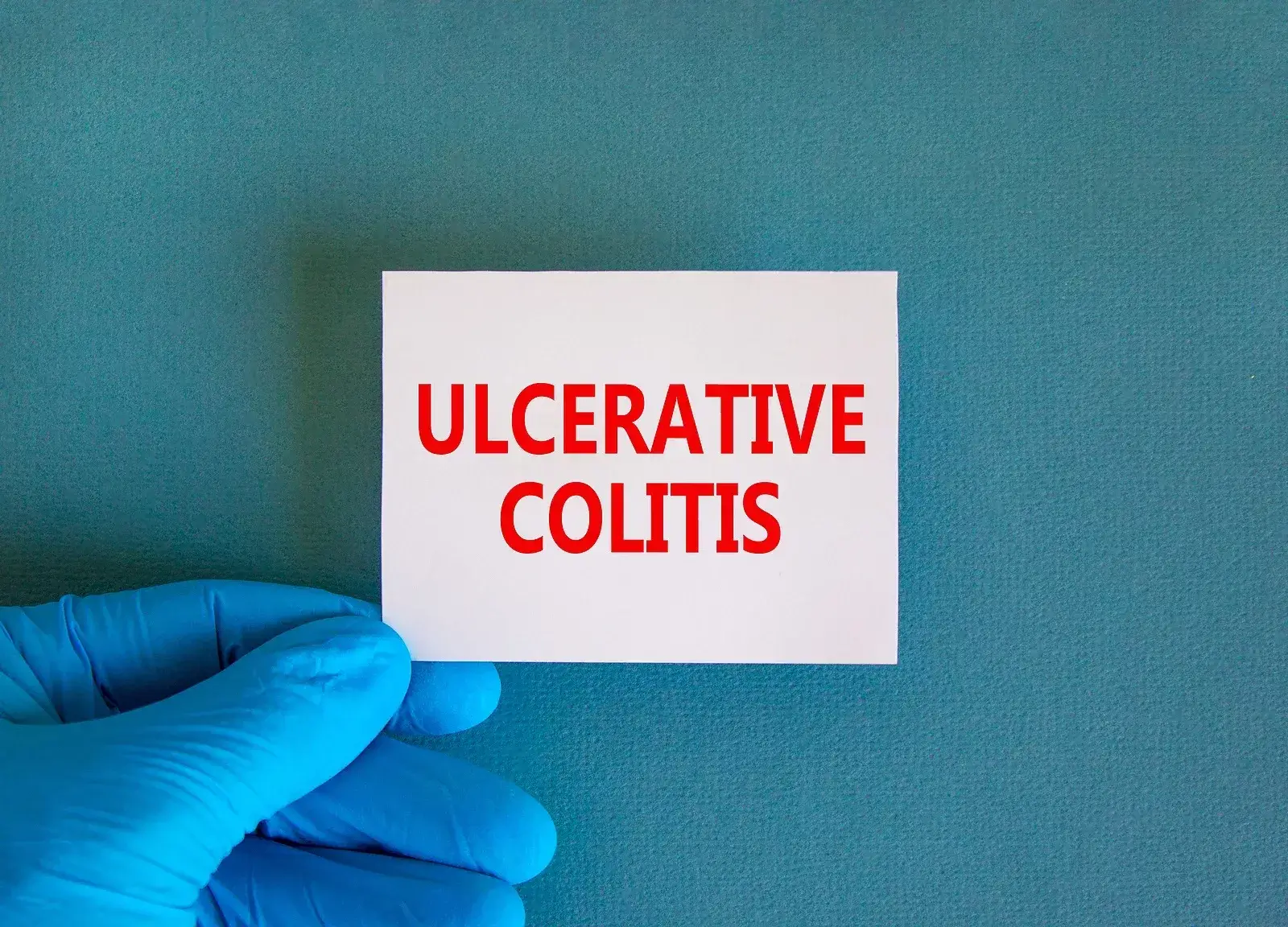 Colitis Ulcerosa